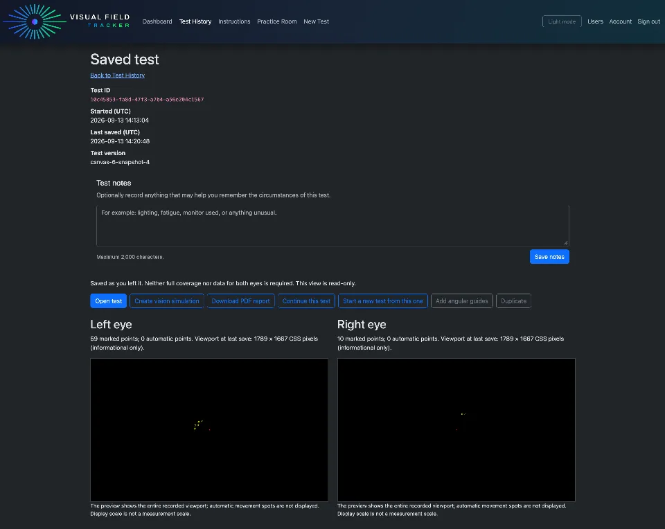 Visual Field Tracker saved session