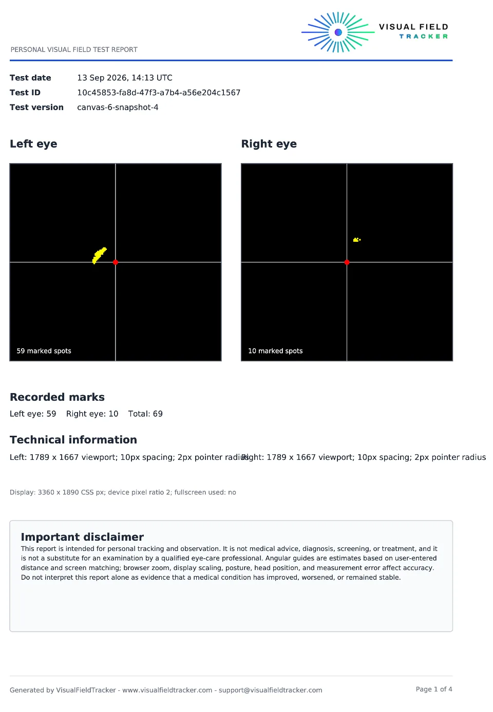 Visual Field Tracker Generated PDF session summary